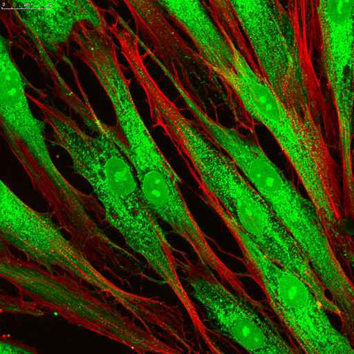 Immunohistochemistry