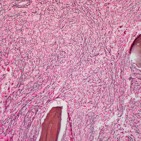 Reticulum Stain Kit - Teomics