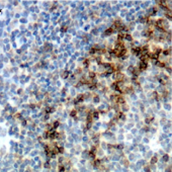 CD45RO, T-Cell (Clone UCHL1) - Teomics