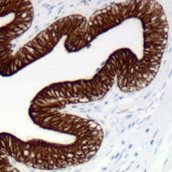 Cytokeratin, Pan (Clone Cocktail) - Teomics