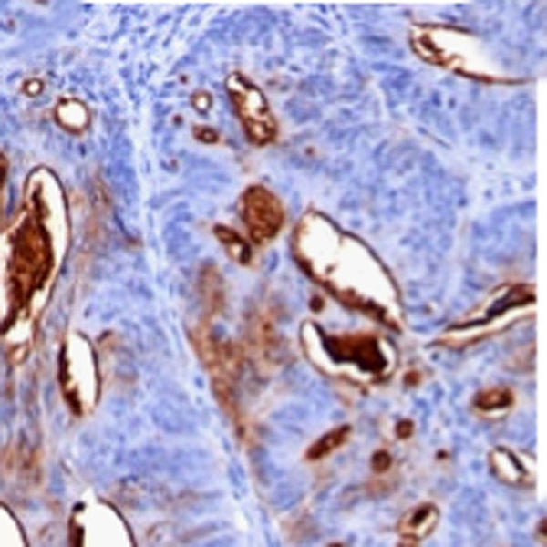 CA19-9; Clone 121SLE - Teomics