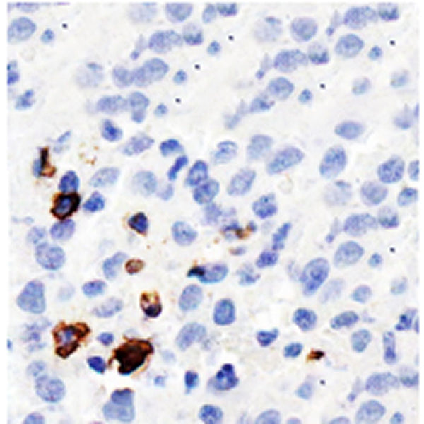 CD57 (HNK-1) (Clone NK-1) - Teomics