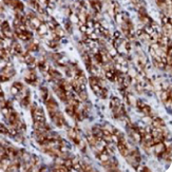 Renal Cell Carcinoma (RCC) (Clone 66.4.C2) - Teomics