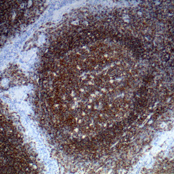 CD45RB; Clone PD7/26 - Teomics