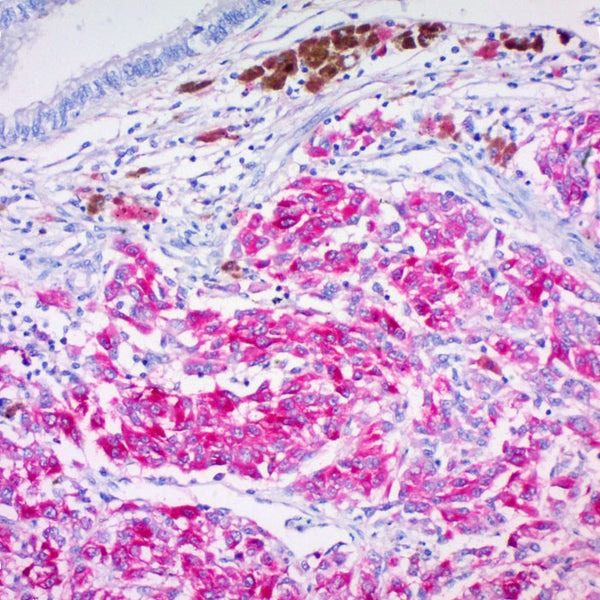 Tyrosinase (Clone T311) - Teomics