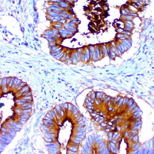 Carcinoembryonic Antigen, Pan (CEA) (Clone COL-1) - Teomics