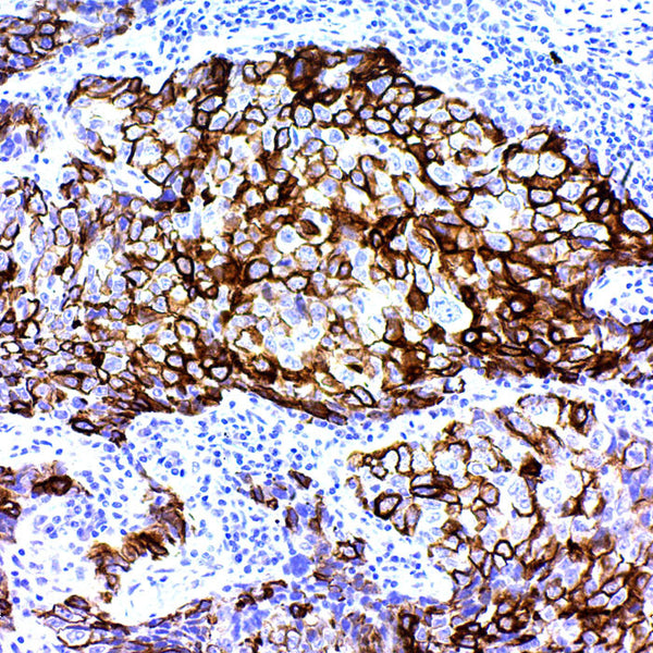Cytokeratin 6 (Clone EP67) - Teomics