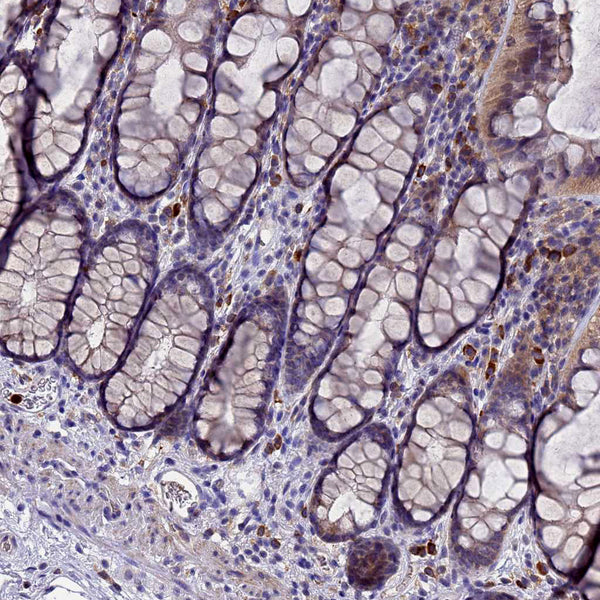 AMP Deaminase, Isoform E (AMPD3) (Clone AMPD3/901) - Teomics