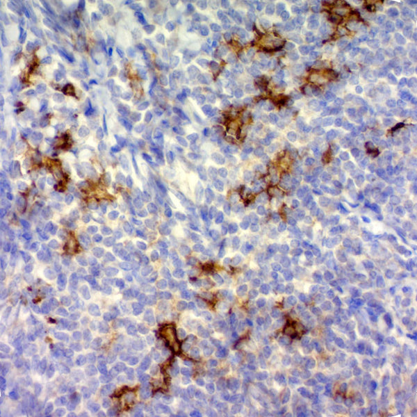 CD1a / HTA1 (Clone O10) - Teomics