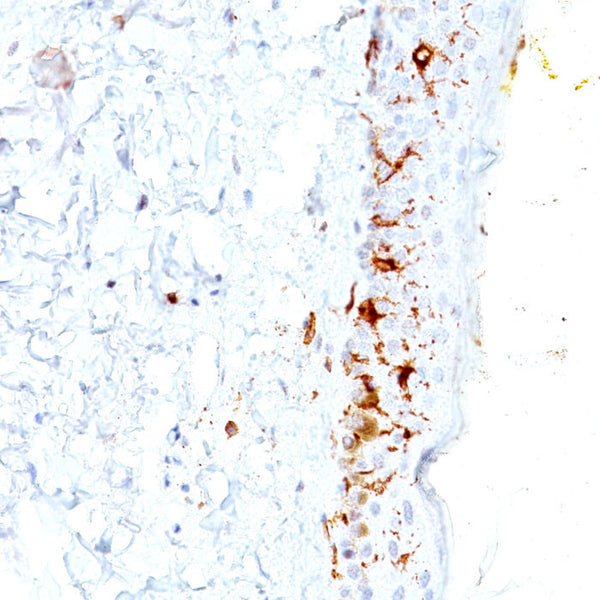 CD1a / HTA1 (Clone C1A/711) - Teomics
