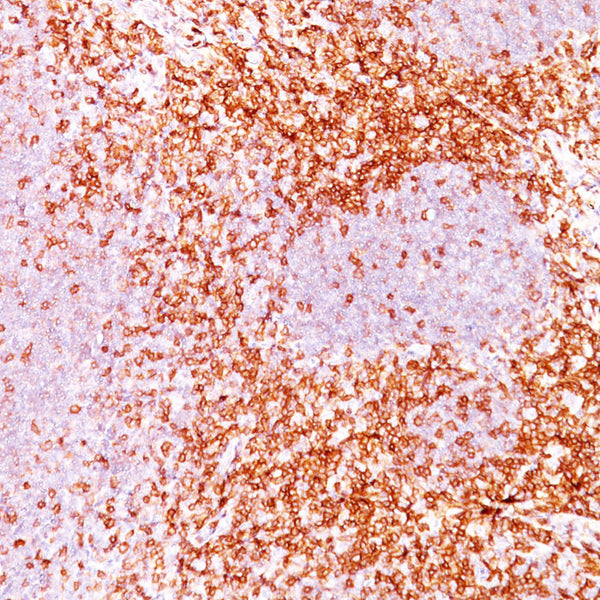 CD6 (Clone 3F7B5) - Teomics