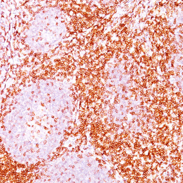 CD6 (Clone C6/372 & 3F7B5) - Teomics