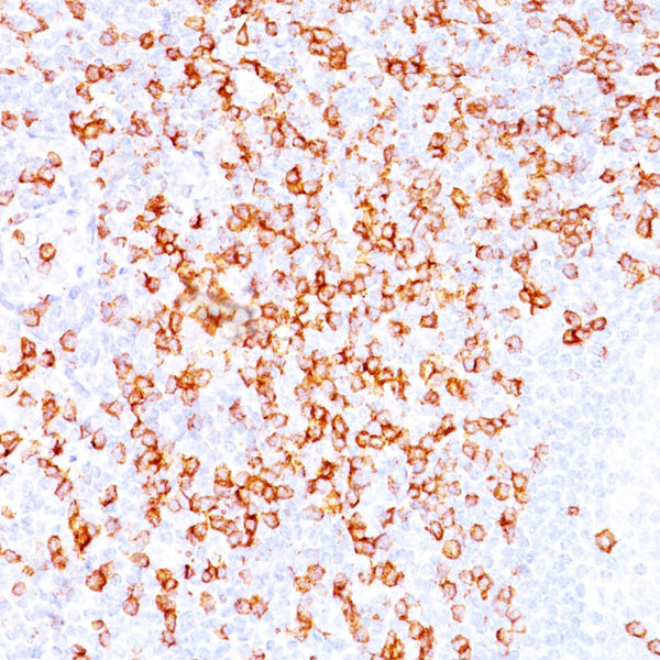 CD8A ( Clone C8/468 & C8/144B) - Teomics