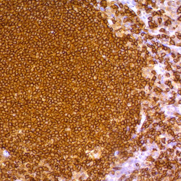 CD20 / MS4A1 (Clone L26) - Teomics