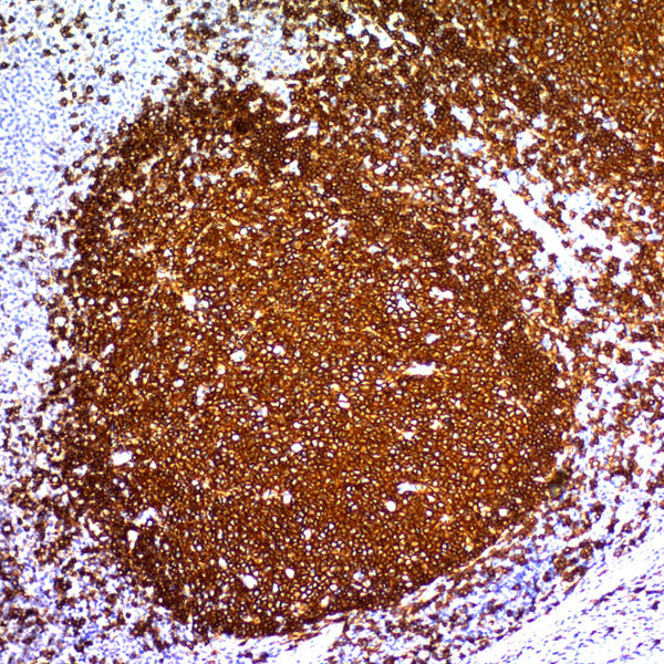 CD20 / MS4A1 (Clone IGEL/773) - Teomics