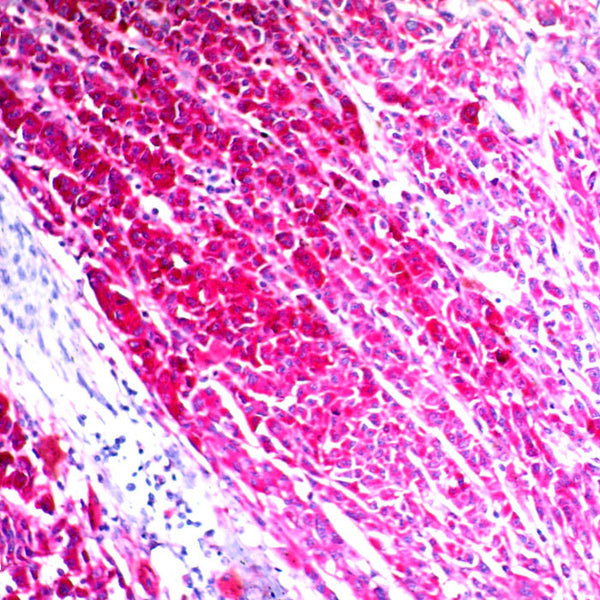CD63 (Clone NKI/C3) - Teomics