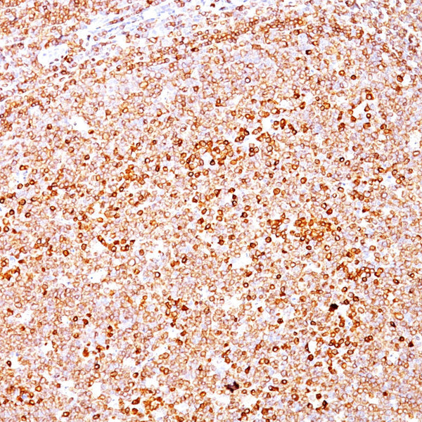 CD79a (Clone HM47/A9) - Teomics