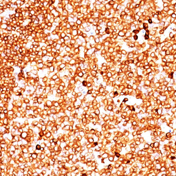 CD79a (Clone JCB117 & HM47/A9) - Teomics