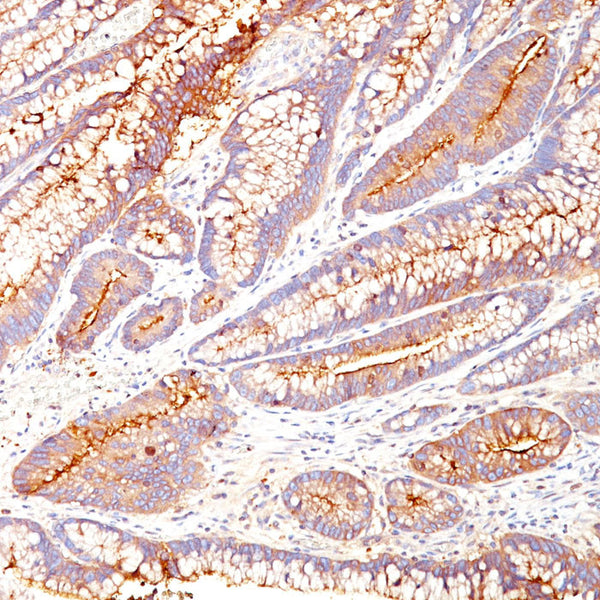 Carcinoembryonic Antigen (CEA) / CD66 (Clone COL-1) - Teomics