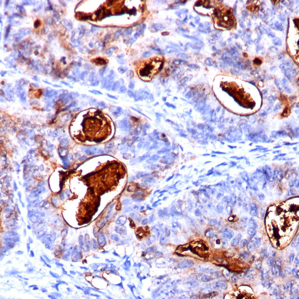 Carcinoembryonic Antigen (CEA) / CD66 (Clone COL-1, CEA31 & C66/261) - Teomics