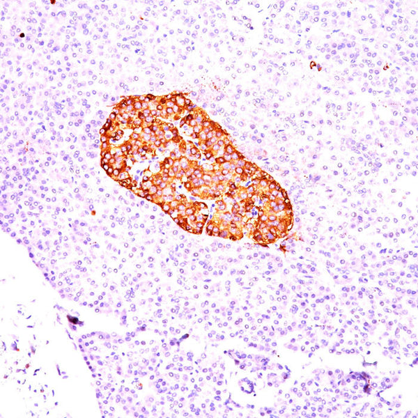 Chromogranin A / CHGA (Clone CGA/414) - Teomics