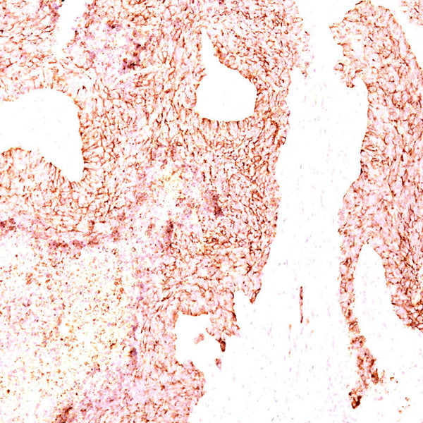 Chromogranin A / CHGA (Clone LK2H10) - Teomics