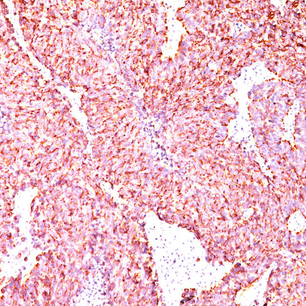 Chromogranin A / CHGA (Clone PHE5) - Teomics