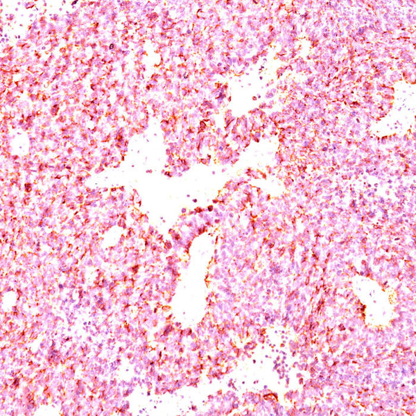 Chromogranin A / CHGA (Clone LK2H10 & PHE5) - Teomics