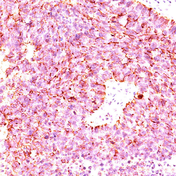 Chromogranin A / CHGA (Clone LK2H10, PHE5 & CGA/414) - Teomics