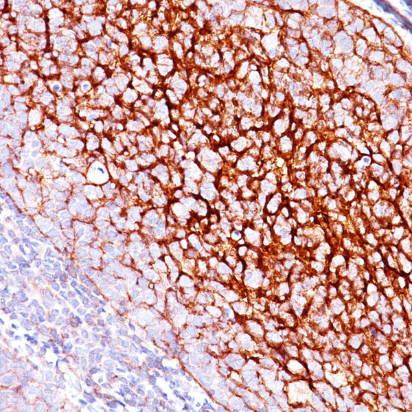 CD35 / CR1 (Clone E11) - Teomics