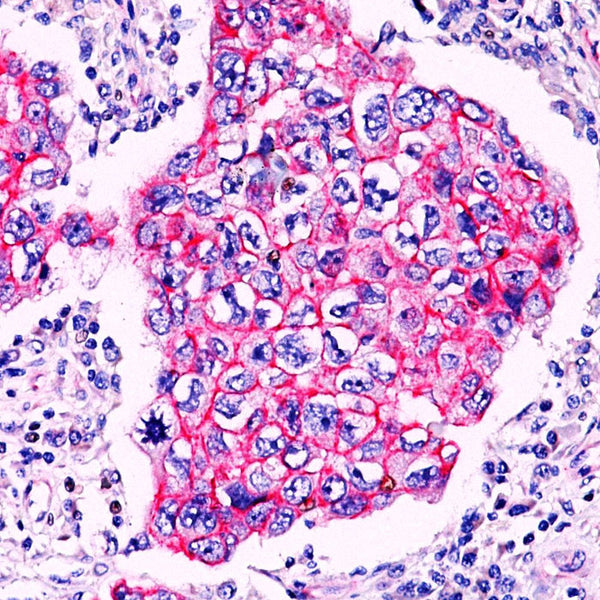 beta-Catenin (p120) (Rabbit Polyclonal) - Teomics