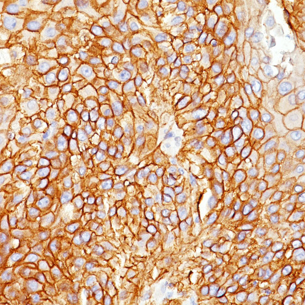 EGFR (Clone GFR450) - Teomics