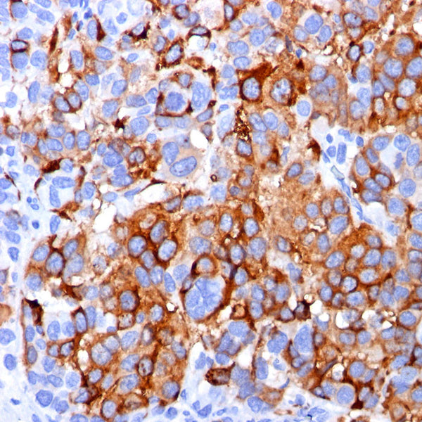 MART-1 / Melan-A / MLANA (Clone A103) - Teomics