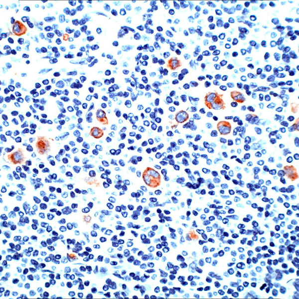 CD15 / FUT4 (Clone Leu-M1 (MMA)) - Teomics
