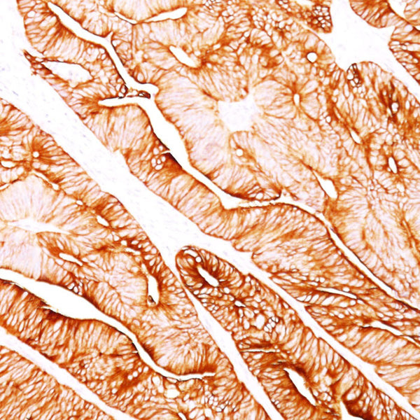 Cytokeratin 8 (KRT8) (Clone H1) - Teomics