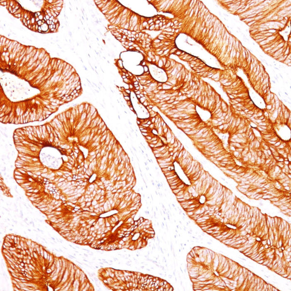 Cytokeratin 8 (KRT8) (Clone K8/383) - Teomics
