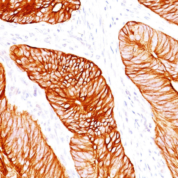 Cytokeratin 8 (KRT8) (Clone H1 & TS1) - Teomics