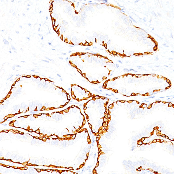 Cytokeratin 14 (KRT14) (Clone LL002) - Teomics