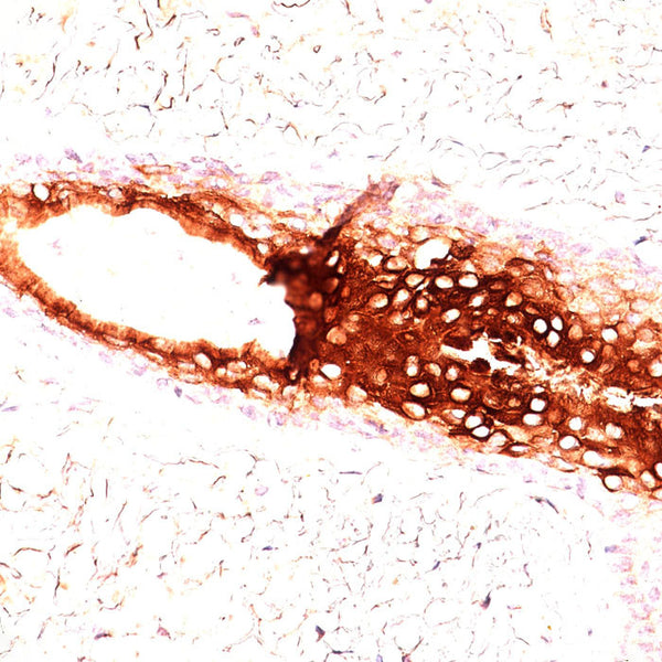 Cytokeratin 17 (KRT17) (Clone E3 (Ks17.E3)) - Teomics