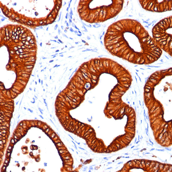 Cytokeratin 18 (KRT18) (Clone DC10) - Teomics