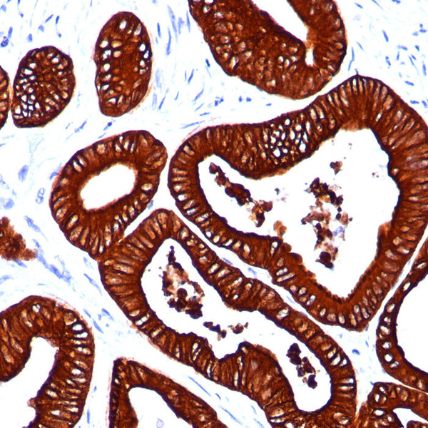 Cytokeratin 19 (KRT19) (Clone BA17) - Teomics