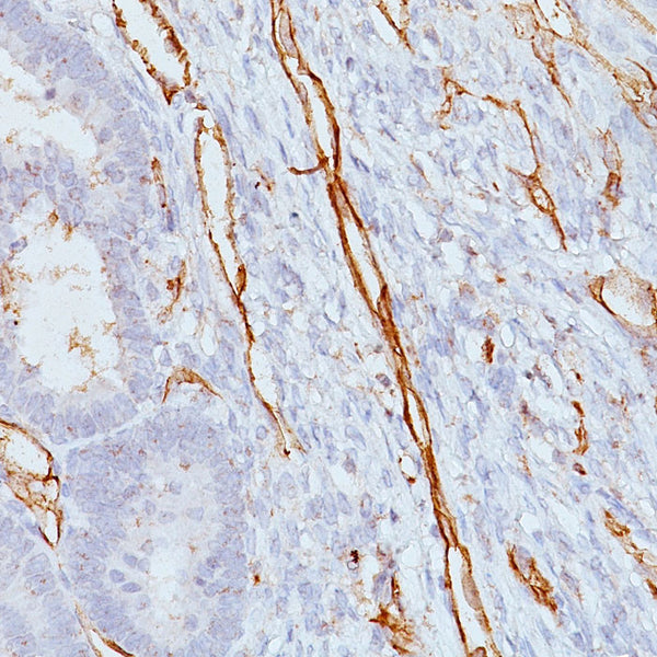 CD31 / PECAM-1 (Clone JC/70A) - Teomics