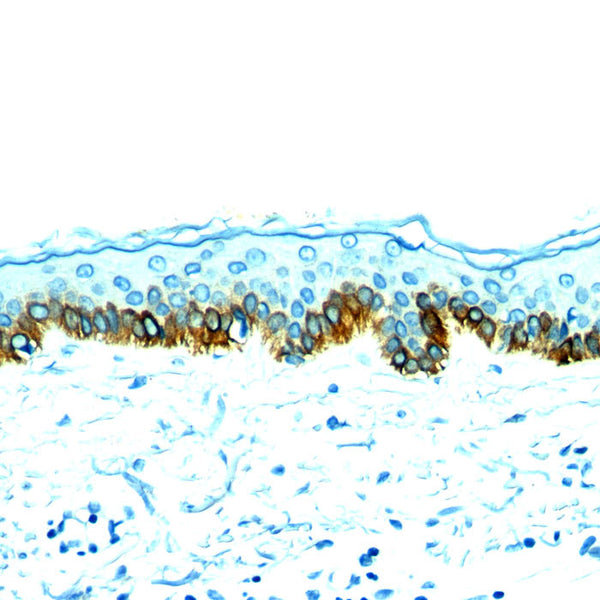 Cytokeratin, Acidic (Type I or LMW) (Clone AE-1) - Teomics
