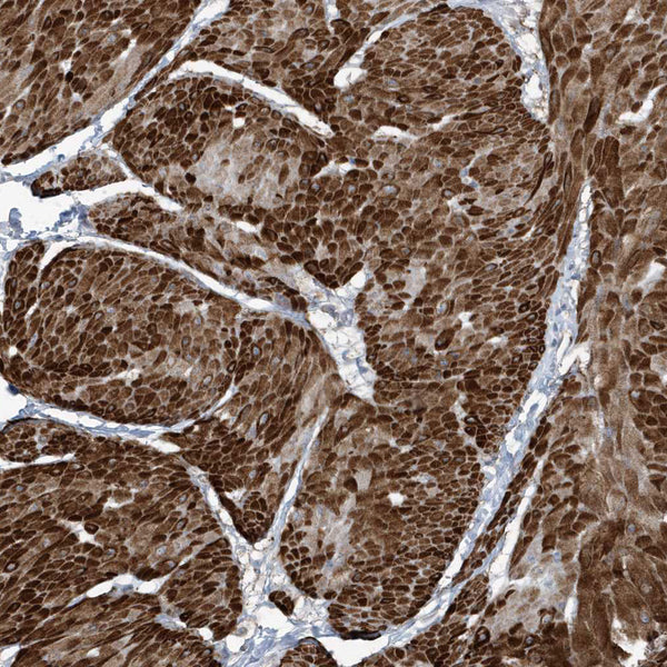 Actin, Muscle Specific (Clone MSA/953) - Teomics