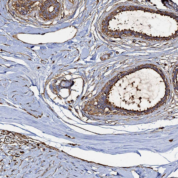 Actin, Smooth Muscle (Clone ACTA2/791) - Teomics