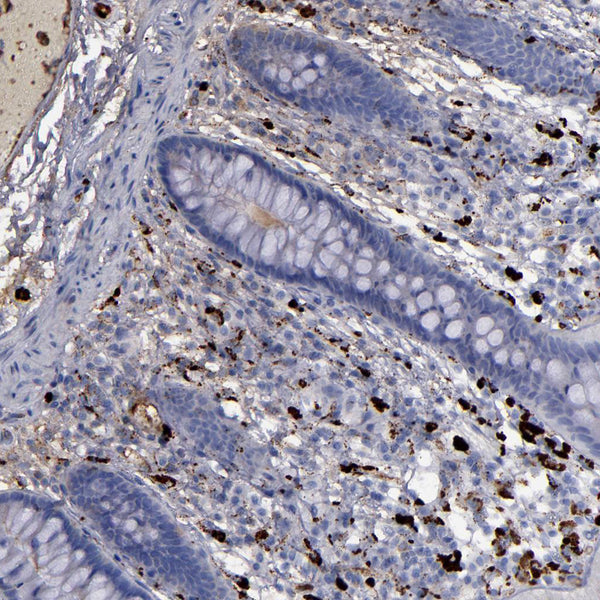 Alpha1-Antichymotrypsin (Rabbit Polyclonal) - Teomics