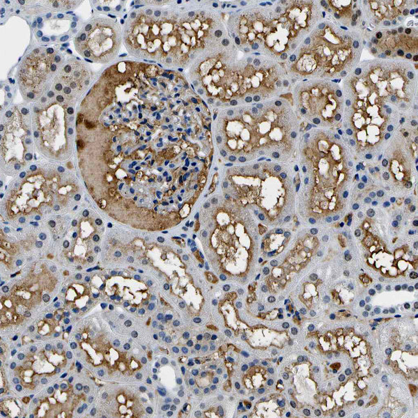 Alpha1-Antitrypsin - Teomics