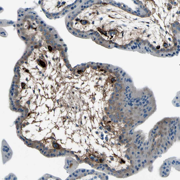 Alpha1-Fetoprotein (AFP) - Teomics