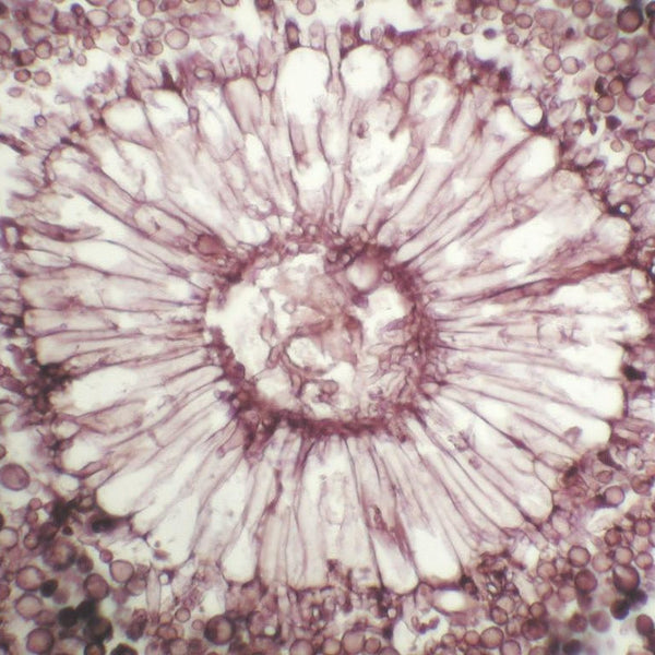 Aspergillus/Fungus (Control Slides) - Teomics