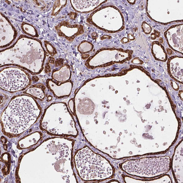 Bcl-2 Oncoprotein (Clone 124) - Teomics